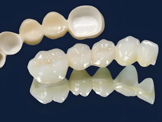 Prezzo e caratteristiche delle corone in zirconio